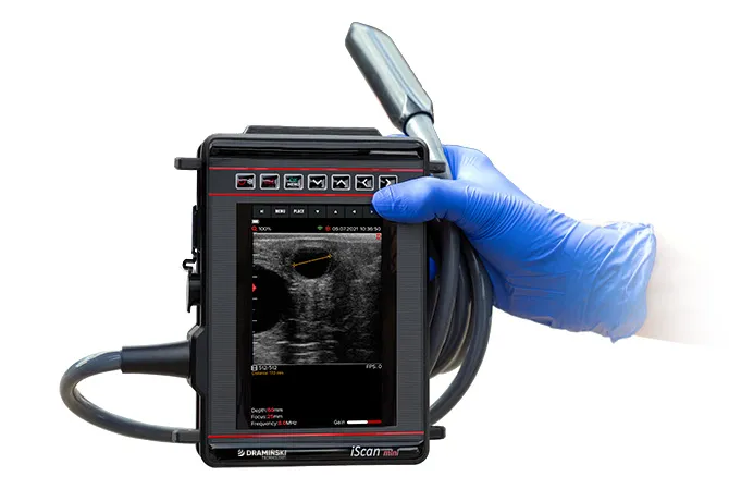 Ecógrafo iScan Mini Dramiński – agarre en mano