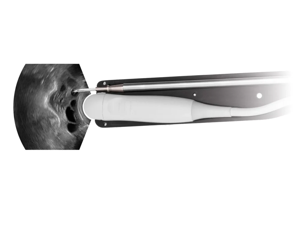 Dramiński – sistema integrado, aspiración precisa de ovocitos