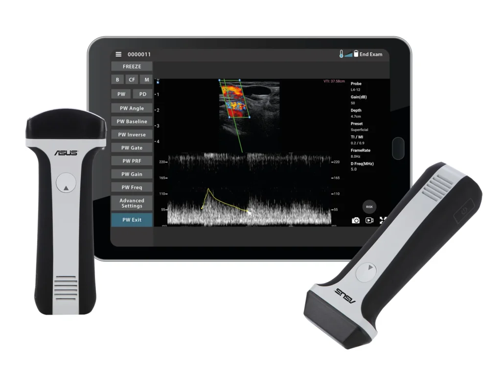 Requisitos de hardware para sondas de ultrasonido inalámbricas ASUS Dramiński