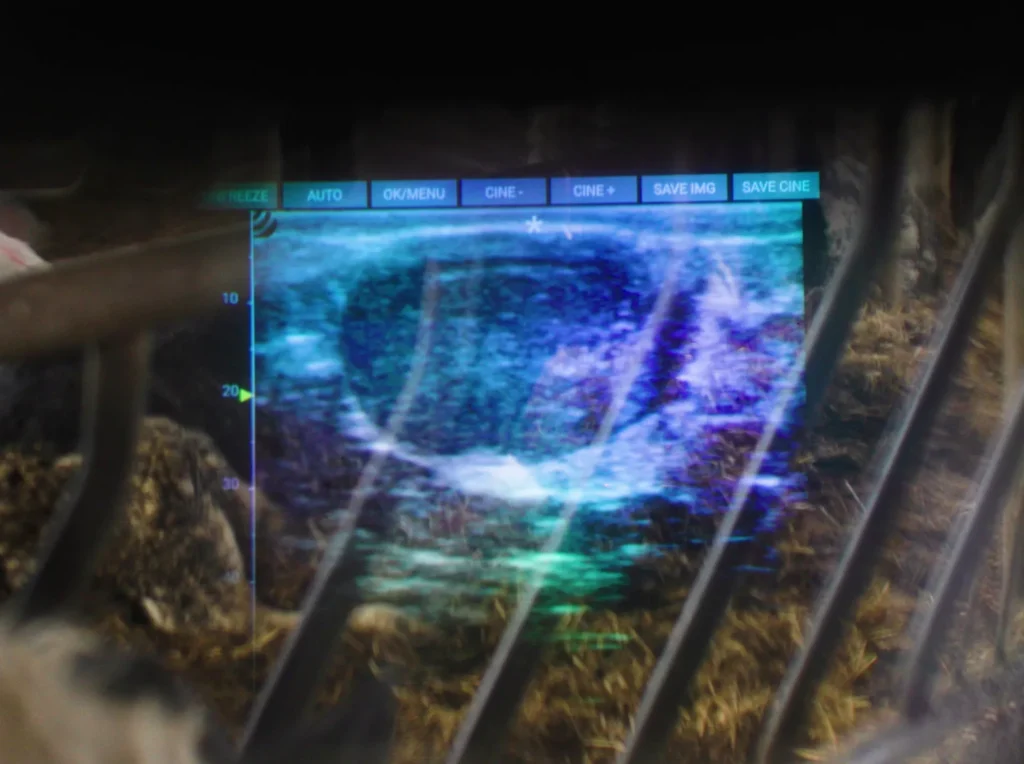 iLens Dramiński – transmisión fluida e inalámbrica de imágenes de ultrasonido