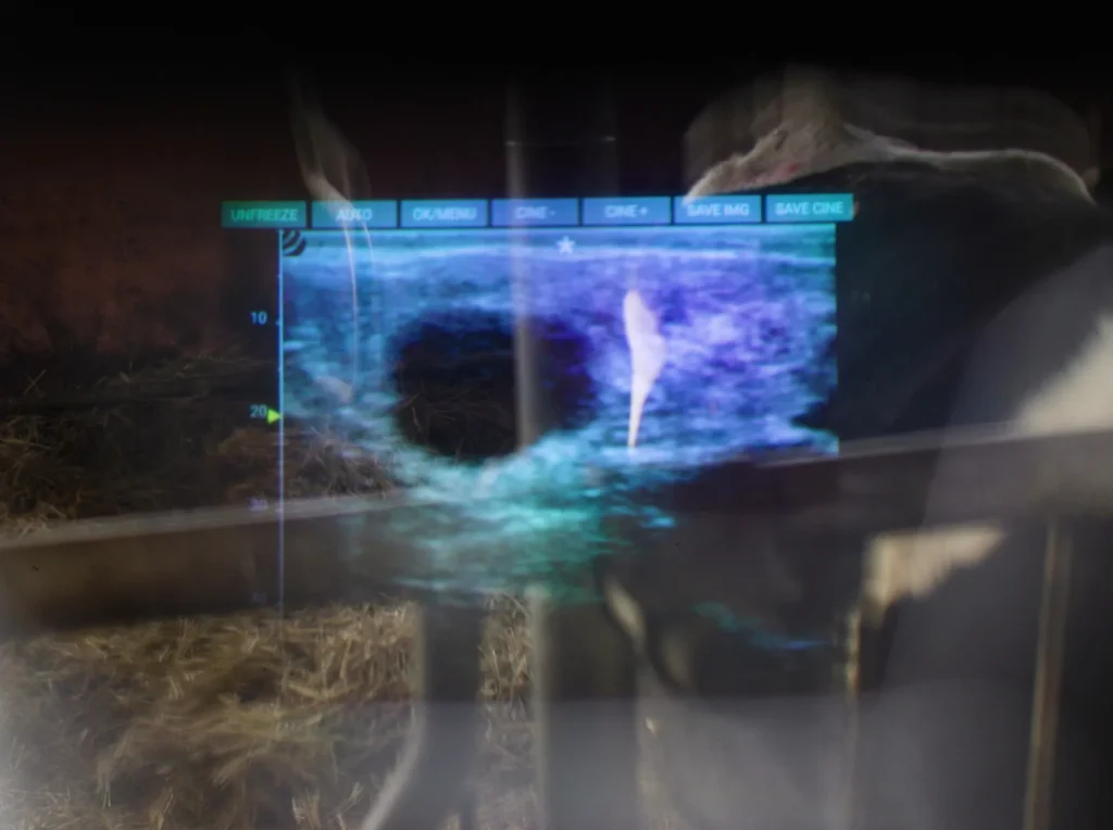 iLens Dramiński – transmisión fluida de imágenes ecográficas sin cable